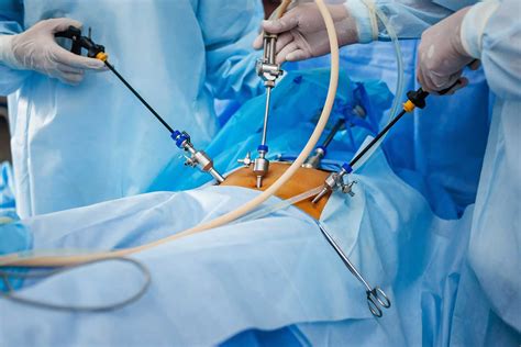 Discover How Laparoscopic Surgery Helps You Heal Quicker and Easier